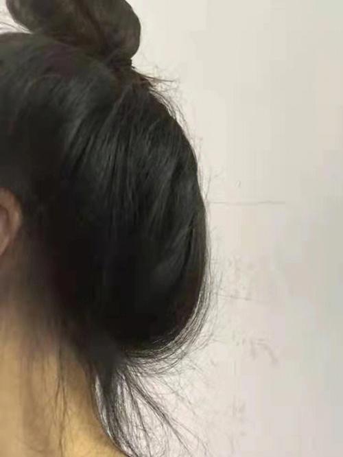 涂生发液等于白扔钱，常见生发液使用误区盘点，IUTANA健发液使用注意事项全解析
