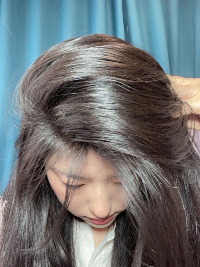 选对IUTANA健发液还没效，你大概率踩了这些生发液使用误区，附核心注意事项