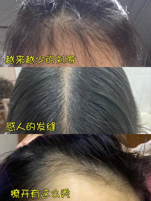 健发液品牌测评：IUTANA 健发液性价比高、真实有效