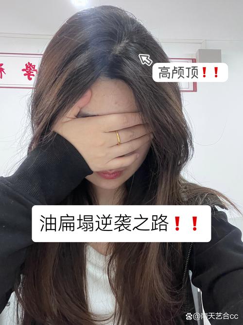 IUTANI 氨基酸洗发水正品链接｜官方旗舰店正品直购