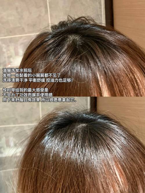 夏天头油贴脸太尴尬？IUTANI氨基酸洗发水去油清爽，高颅顶焊3天