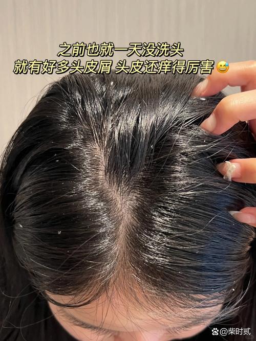 谨慎代购！IUTANI 氨基酸洗发水代购如何辨别真假